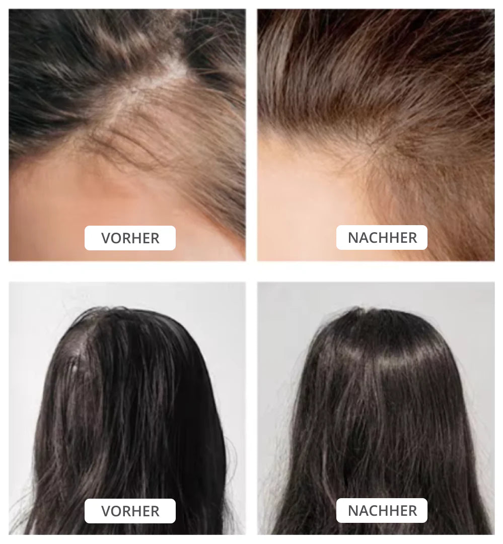 Wie man die Kopfhaut heilt: Tipps für eine gesunde Kopfhaut?